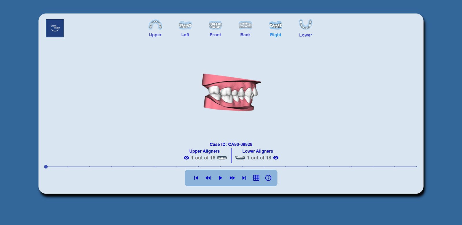Right buccal view.