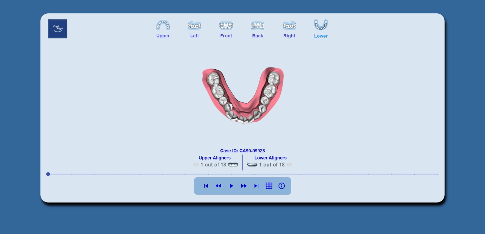 Lower arch from the occlusal.