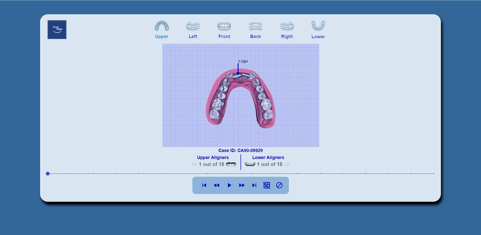 The same call from the occlusal, against the grid.